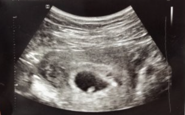 campaign image